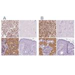 GALM Antibody in Immunohistochemistry (IHC)