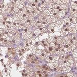 GALM Antibody in Immunohistochemistry (IHC)