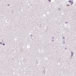 GALM Antibody in Immunohistochemistry (IHC)