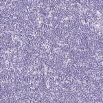 MYO6 Antibody in Immunohistochemistry (Paraffin) (IHC (P))