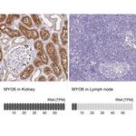 MYO6 Antibody in Immunohistochemistry (IHC)