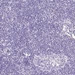 MYO6 Antibody in Immunohistochemistry (IHC)