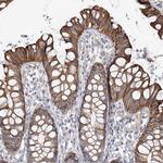 TTC21B Antibody in Immunohistochemistry (Paraffin) (IHC (P))