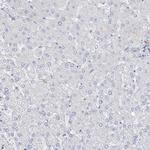 TTC21B Antibody in Immunohistochemistry (Paraffin) (IHC (P))