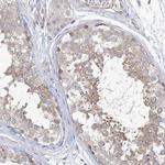 TTC21B Antibody in Immunohistochemistry (Paraffin) (IHC (P))