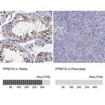 PPM1G Antibody in Immunohistochemistry (IHC)