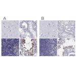 PPM1G Antibody in Immunohistochemistry (IHC)