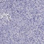 PPM1G Antibody in Immunohistochemistry (IHC)