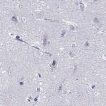 PPM1G Antibody in Immunohistochemistry (IHC)