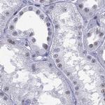 PPM1G Antibody in Immunohistochemistry (IHC)