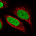 PPM1G Antibody in Immunocytochemistry (ICC/IF)