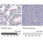 PPM1G Antibody in Immunohistochemistry (IHC)