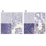 PPM1G Antibody in Immunohistochemistry (IHC)