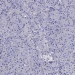 PPM1G Antibody in Immunohistochemistry (IHC)