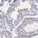 PPM1G Antibody in Immunohistochemistry (IHC)