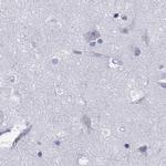 PPM1G Antibody in Immunohistochemistry (IHC)