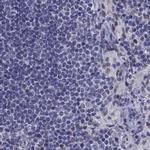 PPM1G Antibody in Immunohistochemistry (IHC)