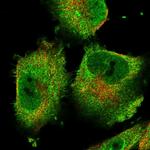 ACOT9 Antibody in Immunocytochemistry (ICC/IF)