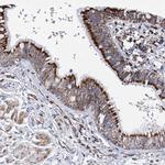 ACOT9 Antibody in Immunohistochemistry (Paraffin) (IHC (P))