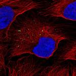 KISS1 Antibody in Immunocytochemistry (ICC/IF)