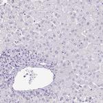 KISS1 Antibody in Immunohistochemistry (IHC)