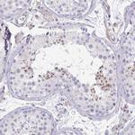 KISS1 Antibody in Immunohistochemistry (IHC)