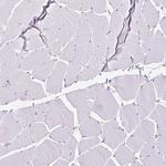 KISS1 Antibody in Immunohistochemistry (IHC)