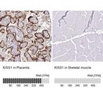 KISS1 Antibody