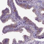 NEK5 Antibody in Immunohistochemistry (IHC)