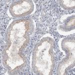 ATP11A Antibody in Immunohistochemistry (Paraffin) (IHC (P))