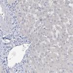 ATP11A Antibody in Immunohistochemistry (Paraffin) (IHC (P))