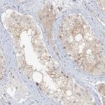 ATP11A Antibody in Immunohistochemistry (Paraffin) (IHC (P))