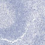 SLC22A13 Antibody in Immunohistochemistry (IHC)