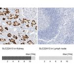 SLC22A13 Antibody