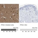 Profilin 2 Antibody in Immunohistochemistry (IHC)