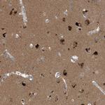 Profilin 2 Antibody in Immunohistochemistry (IHC)