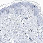 Profilin 2 Antibody in Immunohistochemistry (IHC)