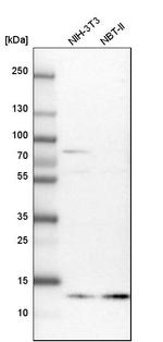 Profilin 2 Antibody in Western Blot (WB)