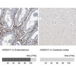 HOXA11 Antibody in Immunohistochemistry (IHC)