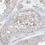 HOXA11 Antibody in Immunohistochemistry (IHC)