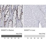 B3GNT7 Antibody