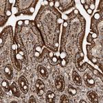 AARS2 Antibody in Immunohistochemistry (Paraffin) (IHC (P))