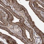 AARS2 Antibody in Immunohistochemistry (Paraffin) (IHC (P))