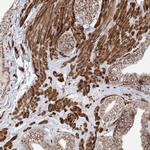 AARS2 Antibody in Immunohistochemistry (Paraffin) (IHC (P))