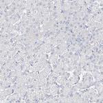 VILL Antibody in Immunohistochemistry (IHC)