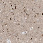 RPP40 Antibody in Immunohistochemistry (Paraffin) (IHC (P))