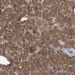 RPP40 Antibody in Immunohistochemistry (Paraffin) (IHC (P))