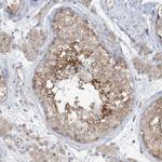 RPP40 Antibody in Immunohistochemistry (Paraffin) (IHC (P))