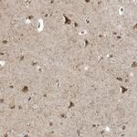 RPP40 Antibody in Immunohistochemistry (IHC)