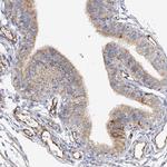 NELL2 Antibody in Immunohistochemistry (IHC)